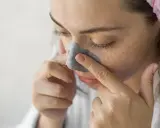 Jak usunąć pryszcza z nosa? Szybkie i bezpieczne metody