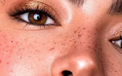 Henna do piegów: naturalne i trwałe. Jak to zrobić bezpiecznie?
