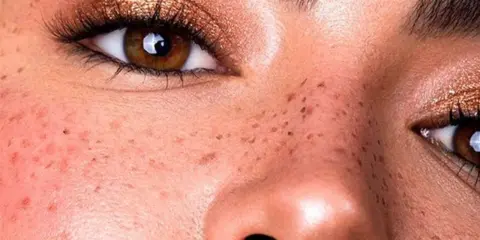 Henna do piegów: naturalne i trwałe. Jak to zrobić bezpiecznie?