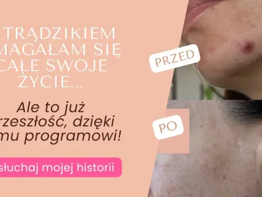 Co działa na pryszcze? Odkryj skuteczne metody i czystą cerę!