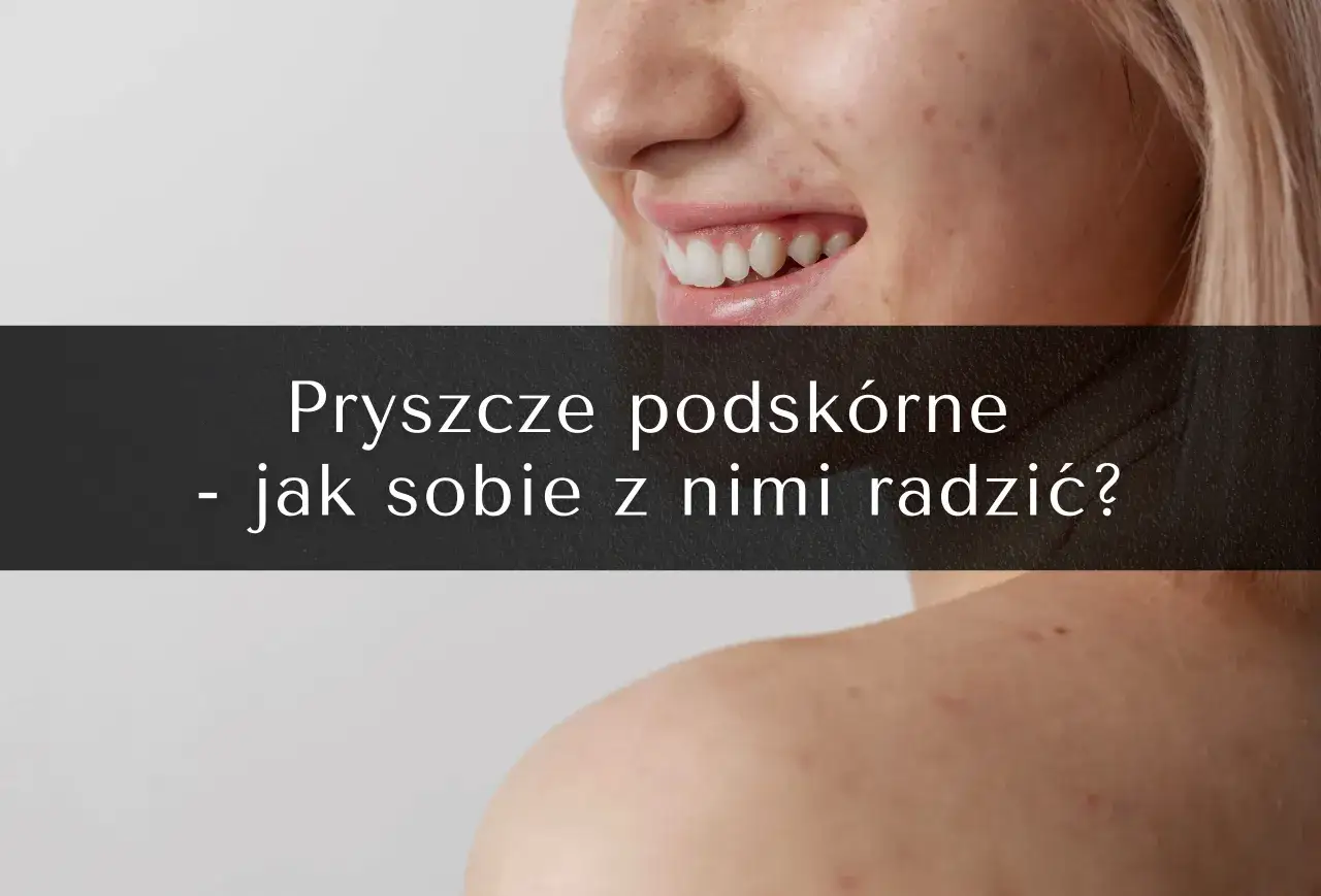 okłady na pryszcze podskórne