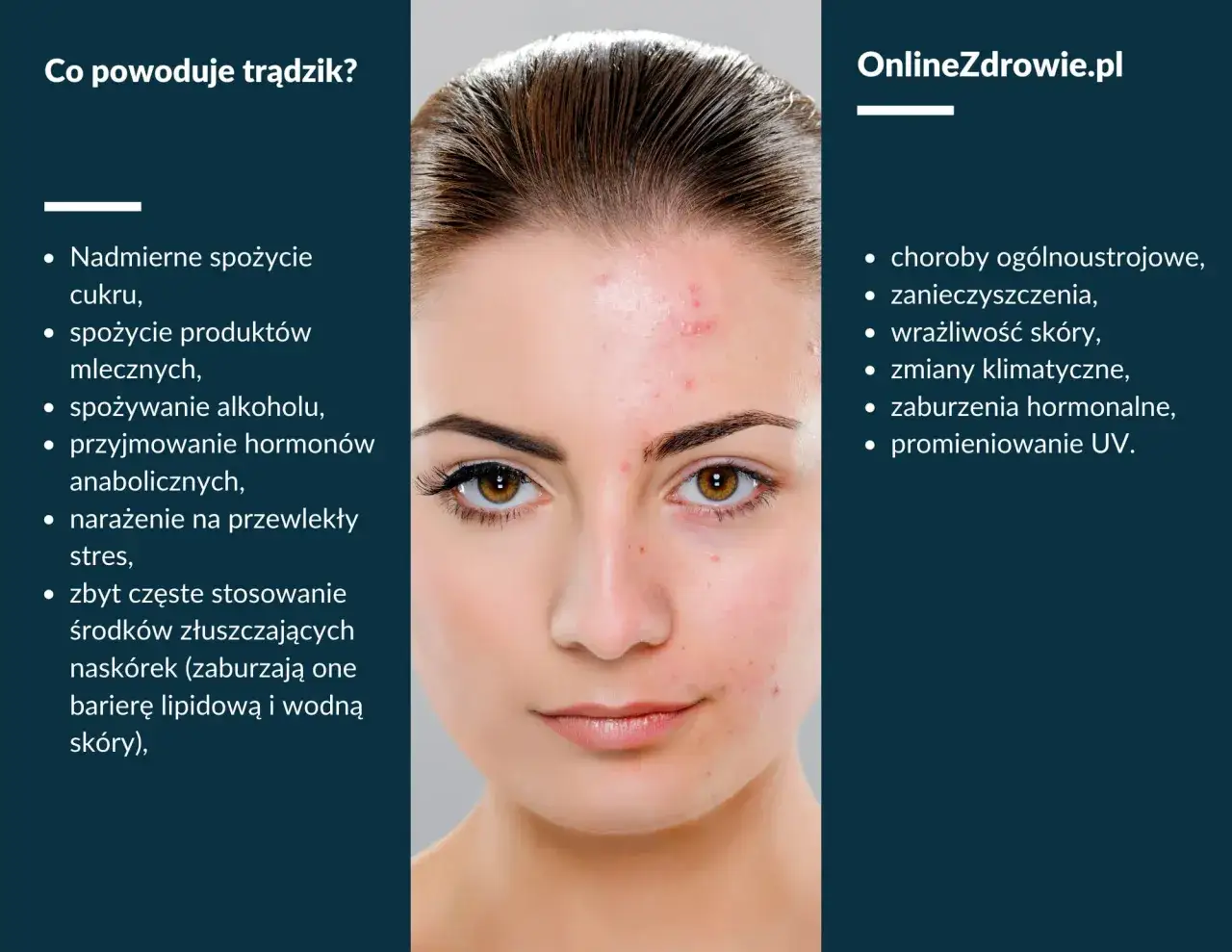 przyczyny trądziku infografika